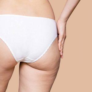 contrasto cellulite